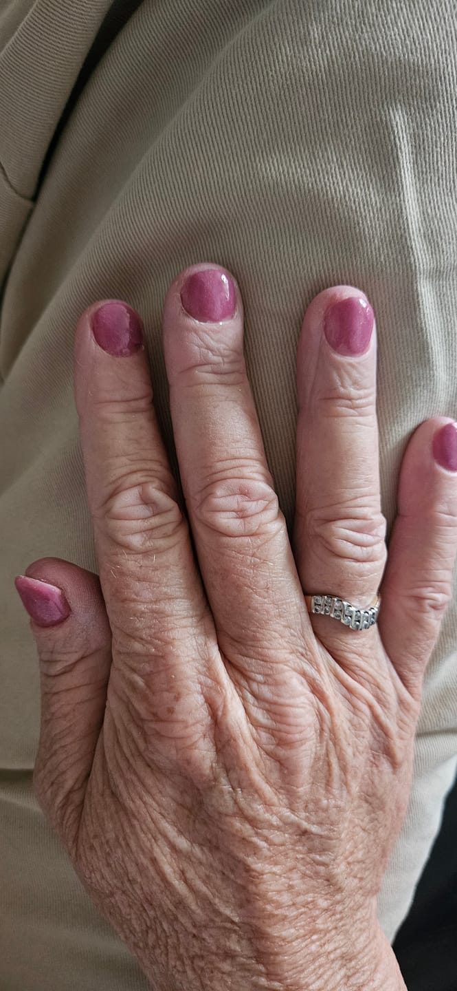 Customer photo review of Glowdip Alles-in-één Manicure Set