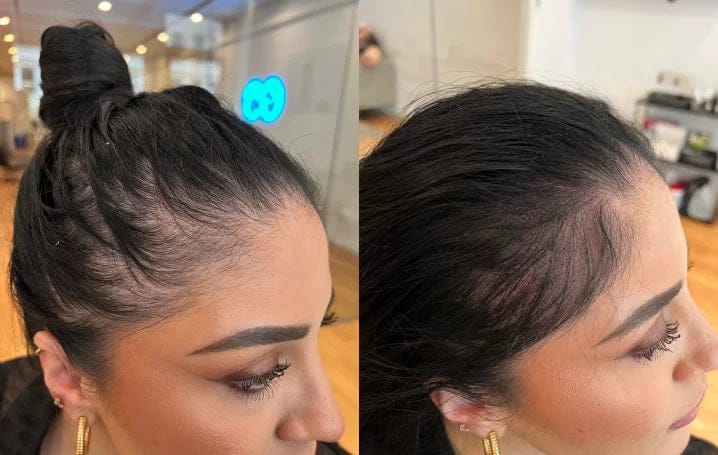 Customer photo review of Nolya Red Light Therapy Hair Brush