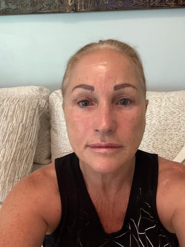 Customer photo review of Affordable Glass Glow Skincare Set