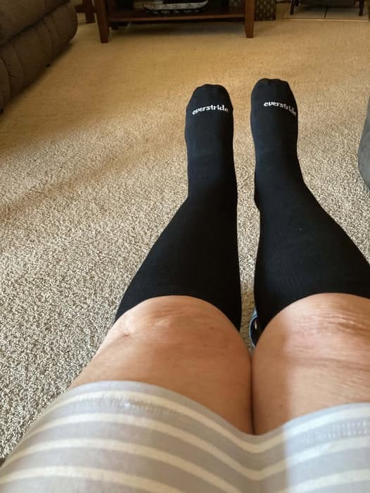 Customer photo review of EverSock™ Bamboo Compression Socks