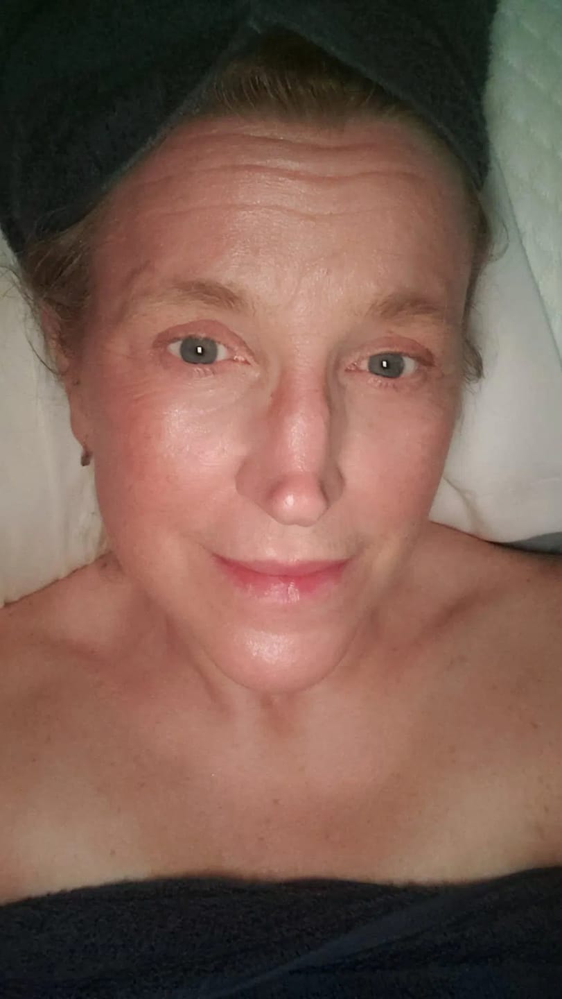 Customer photo review of COLLAGEN MASK