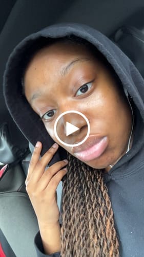 Customer photo review of Collagen Niacinamide Jelly Cream