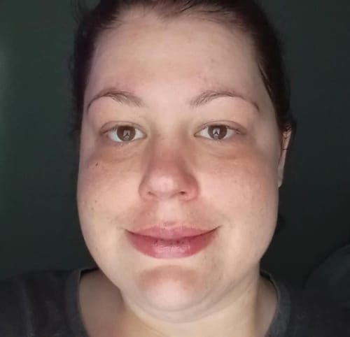 Customer photo review of Affordable Glass Glow Skincare Set