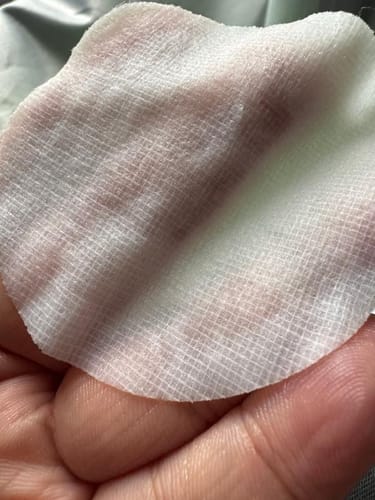 Customer photo review of Exosome Cica Calming Toner Pads