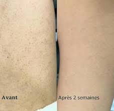 Customer photo review of YVELYS Soin Lissant Peau de Fraise