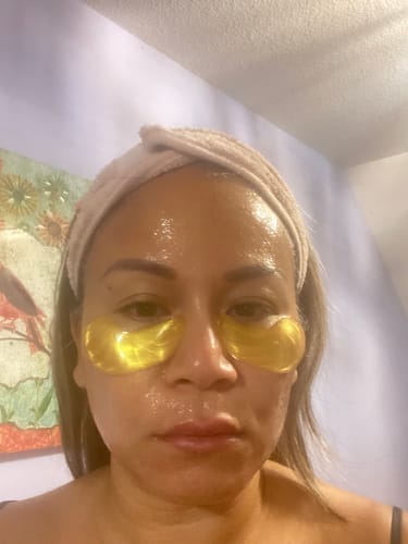 Customer photo review of Quia Collagen Eye Patches