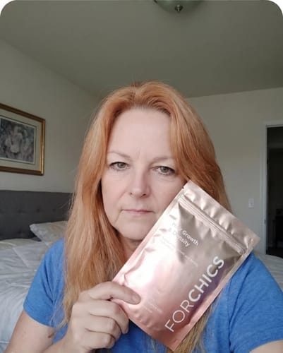 Customer photo review of ForChics Hair Growth Density
