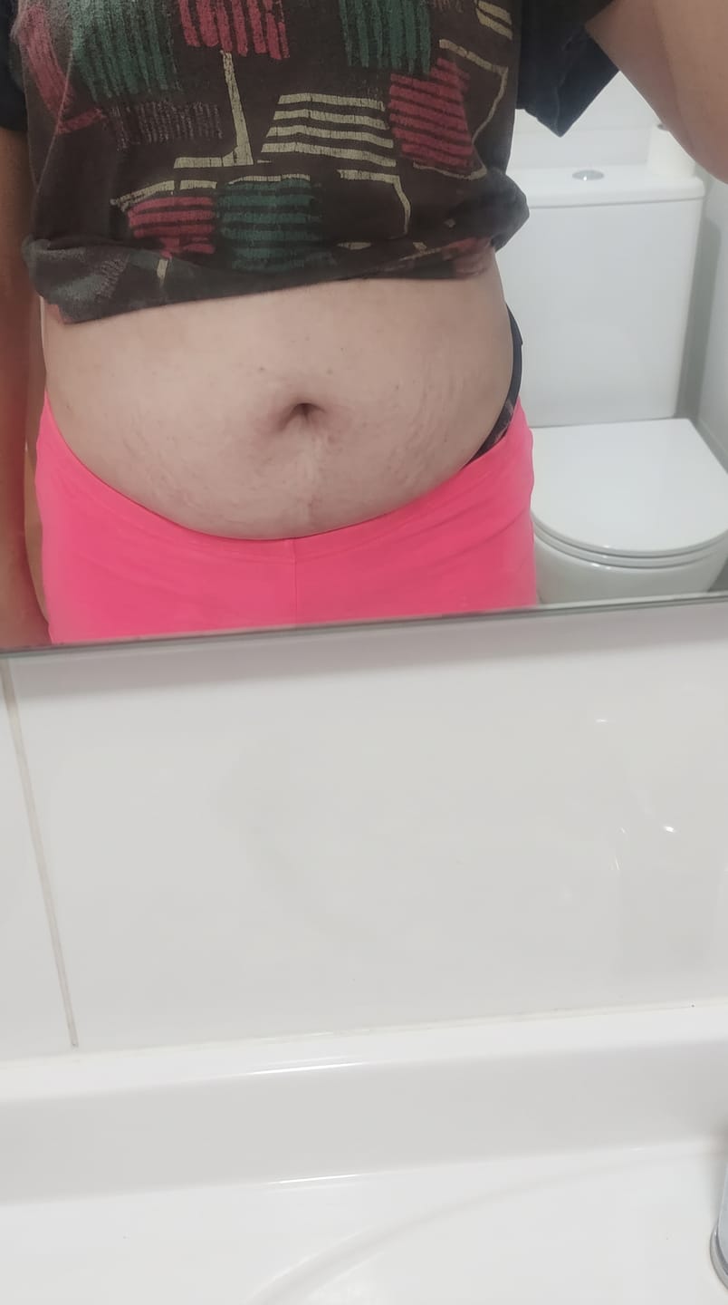 Customer photo review of BellyGap™ — Riñonera con estampado de barriga