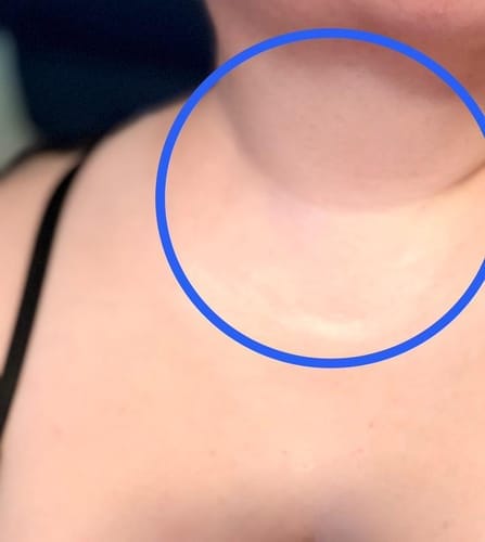 Customer photo review of Triple Collagen Toner