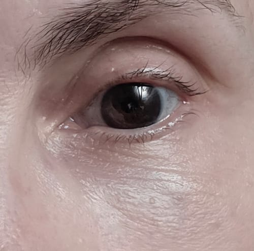 Customer photo review of Magic Revive Eye Balm