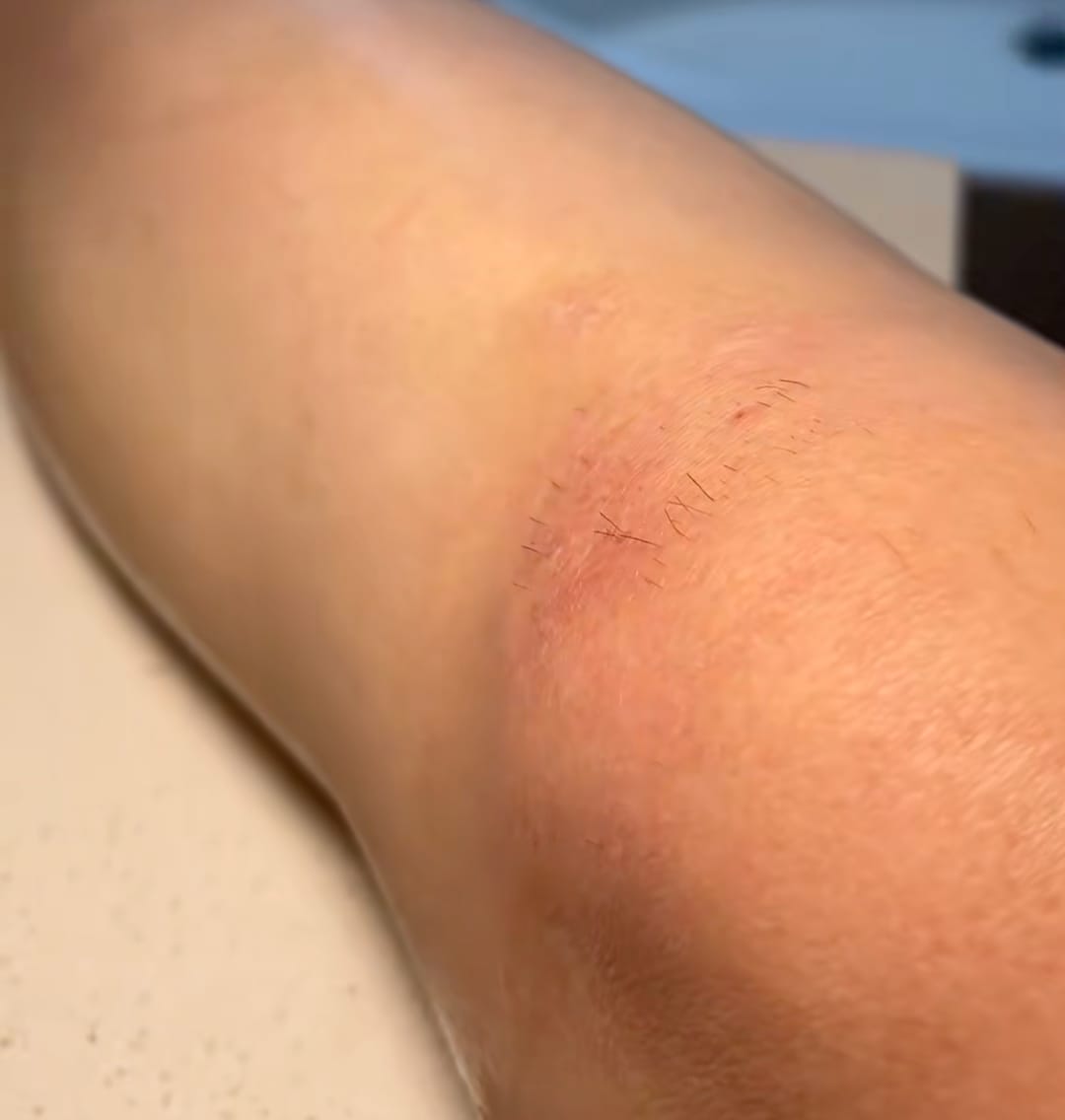 Customer photo review of Bump-Free Shaver