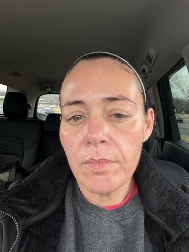 Customer photo review of Triple Collagen Serum