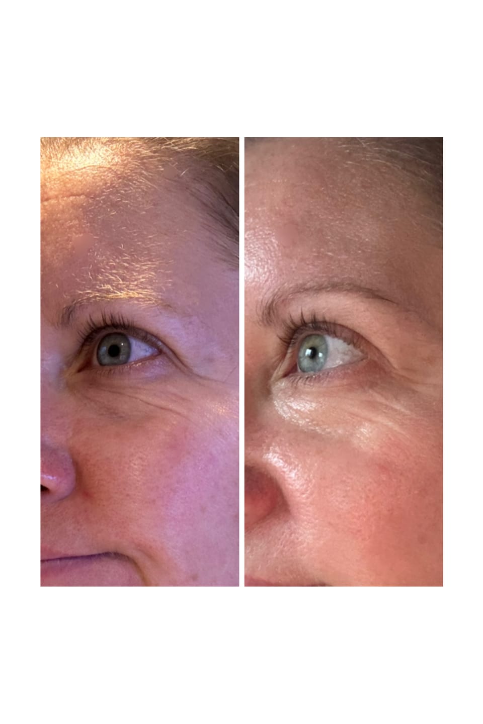 Customer photo review of Anti-Fatigue Eye Mask