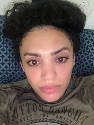 Customer photo review of No More Pore Pads