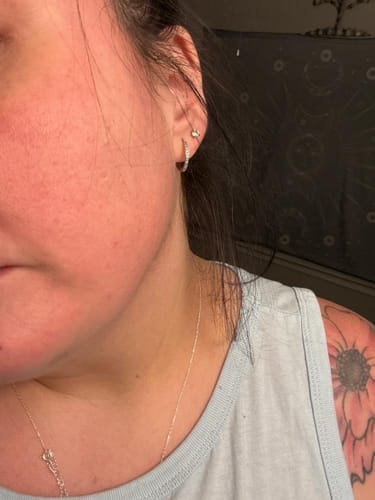 Customer photo review of Affordable Glass Glow 7-Day Skincare Set