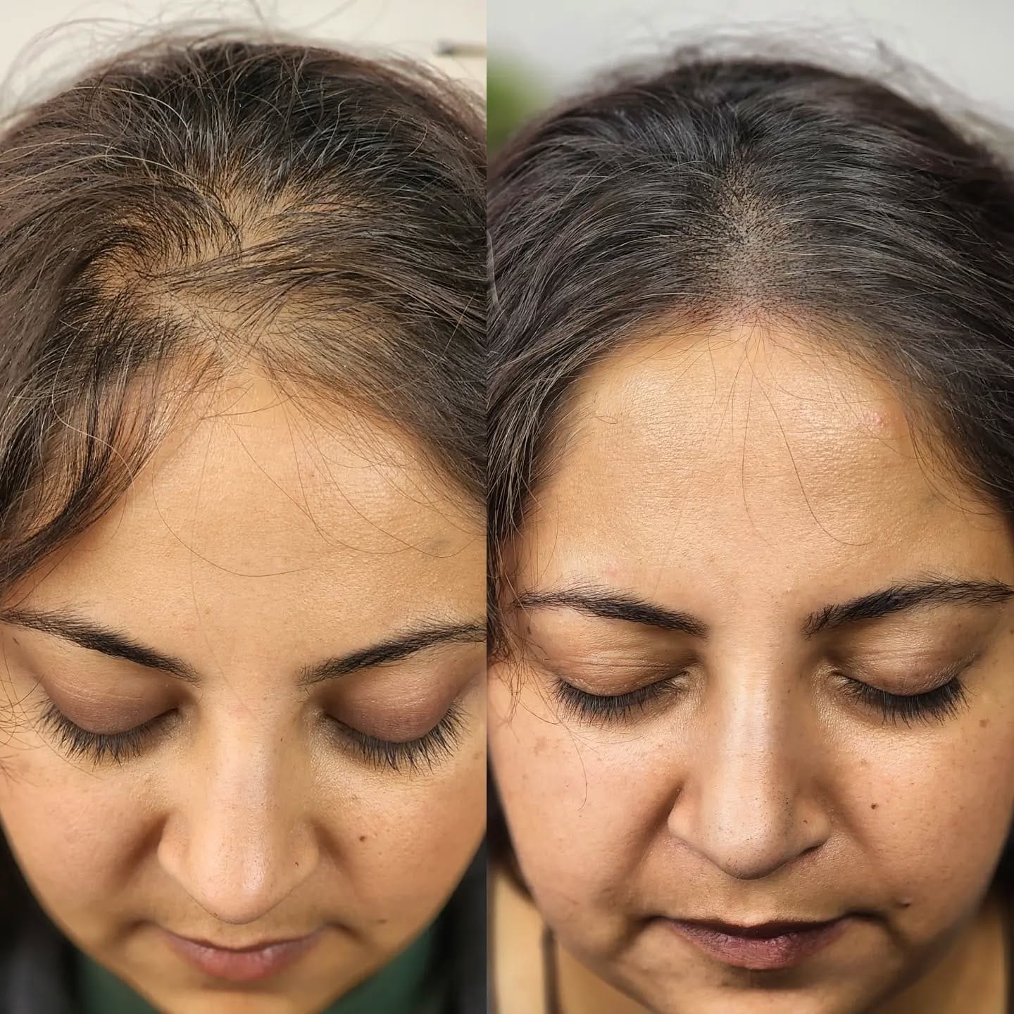 Customer photo review of Nolya Red Light Therapy Hair Brush