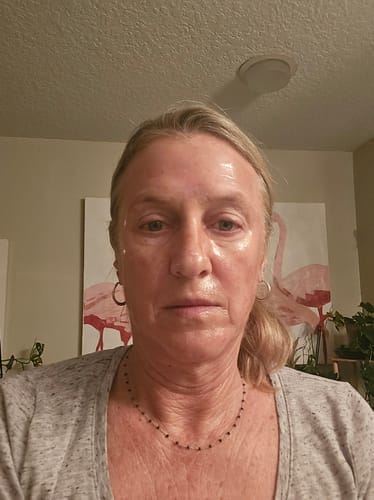 Customer photo review of Korean Collagen Night Wrapping Mask