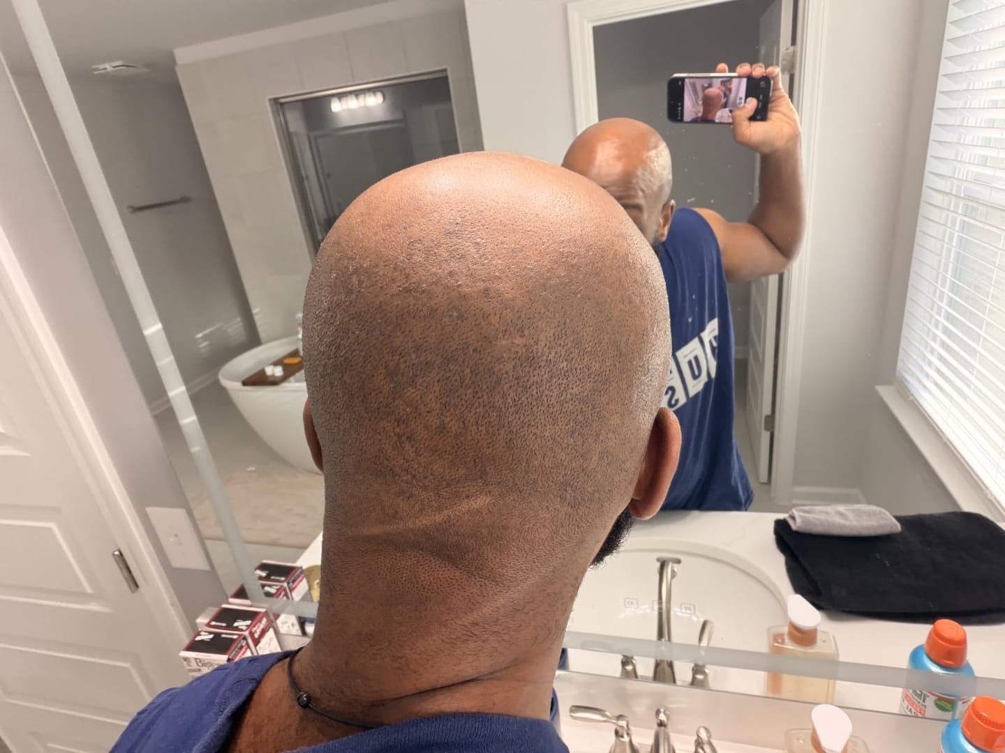 Customer photo review of Ingrown Hair Reset Duo