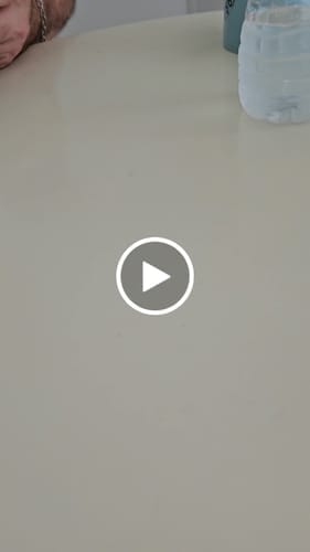 Customer photo review of Duftstofffreie, nicht fettende Anti-Juckreiz-Lotion mit Ceramid NP für trockene, gerötete und empfindliche Haut