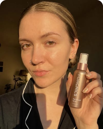 Customer photo review of ForChics Hair Growth Spray