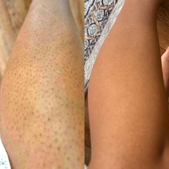 Customer photo review of YVELYS Soin Lissant Peau de Fraise