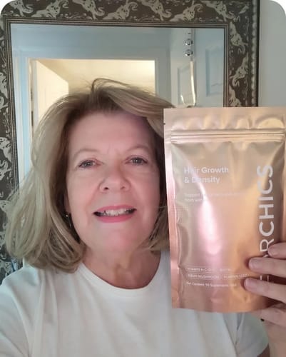 Customer photo review of ForChics Hair Growth Density