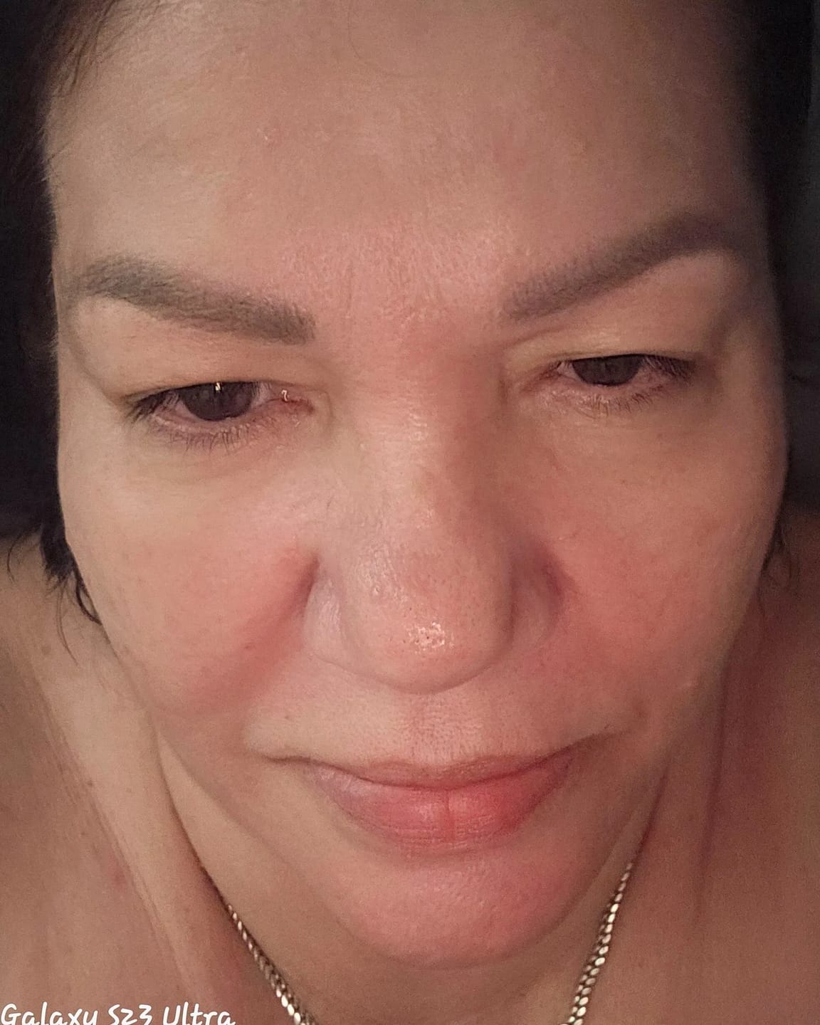 Customer photo review of COLLAGEN MASK