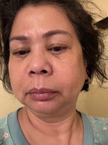 Customer photo review of Collagen Jelly Cream with Niacinamide