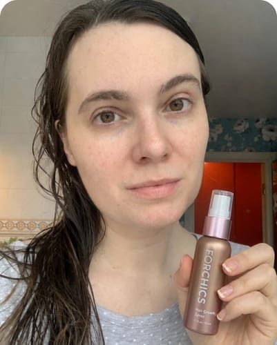 Customer photo review of ForChics Hair Growth Spray