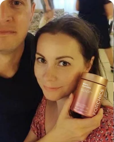Customer photo review of ForChics Biotin Gummies