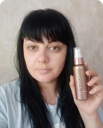 Customer photo review of ForChics Hair Growth Spray