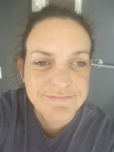 Customer photo review of No More Pore Pads