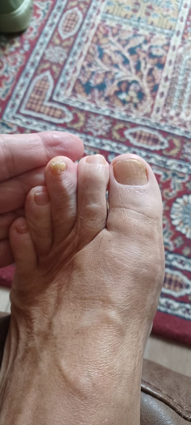 Customer photo review of Fungal Freedom