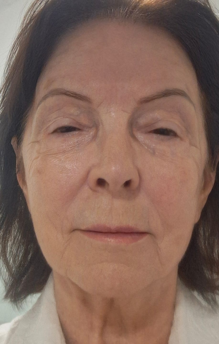 Customer photo review of Bálsamo de Cálcio 4 em 1 Efeito Lifting Instantâneo - CALCIUM LUXE™