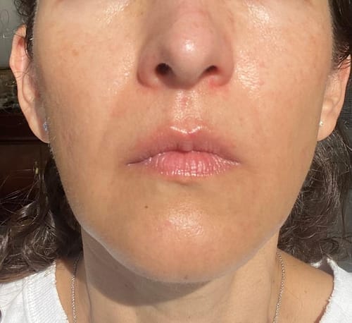 Customer photo review of Exosome Cica Calming Toner Pads