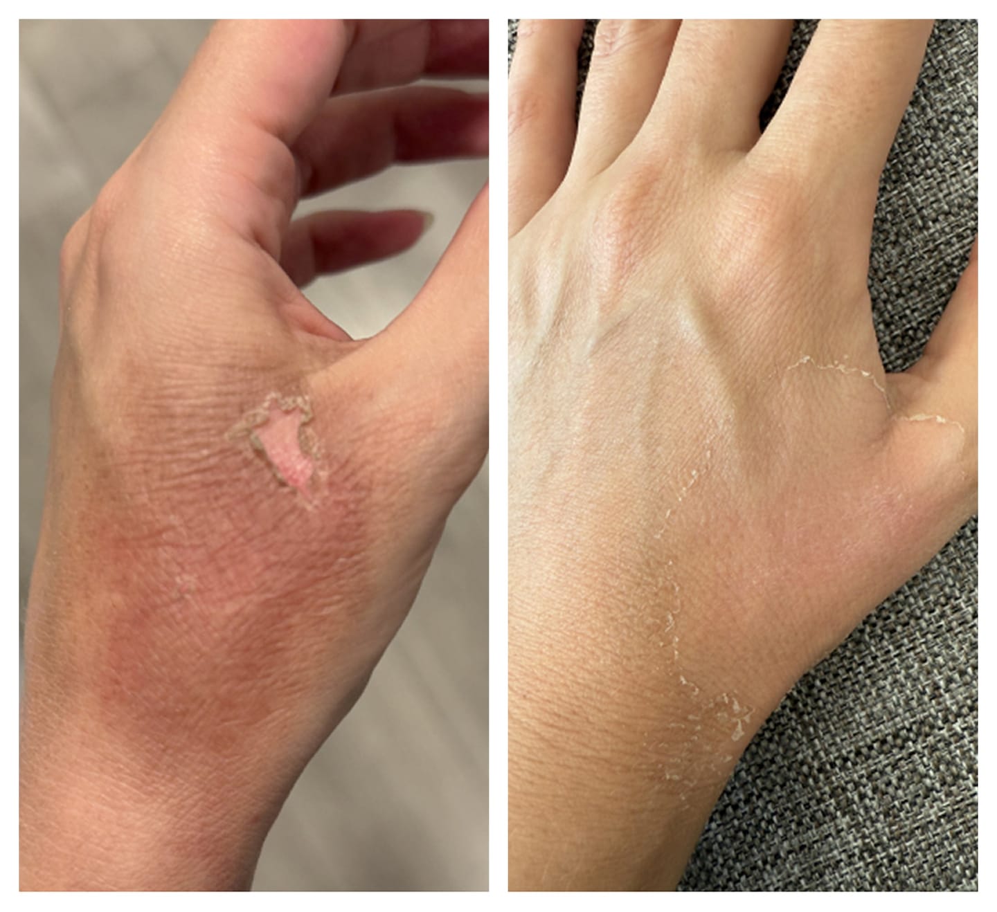 Customer photo review of Ultra Nourishing Arctic Botanicals Body Balm