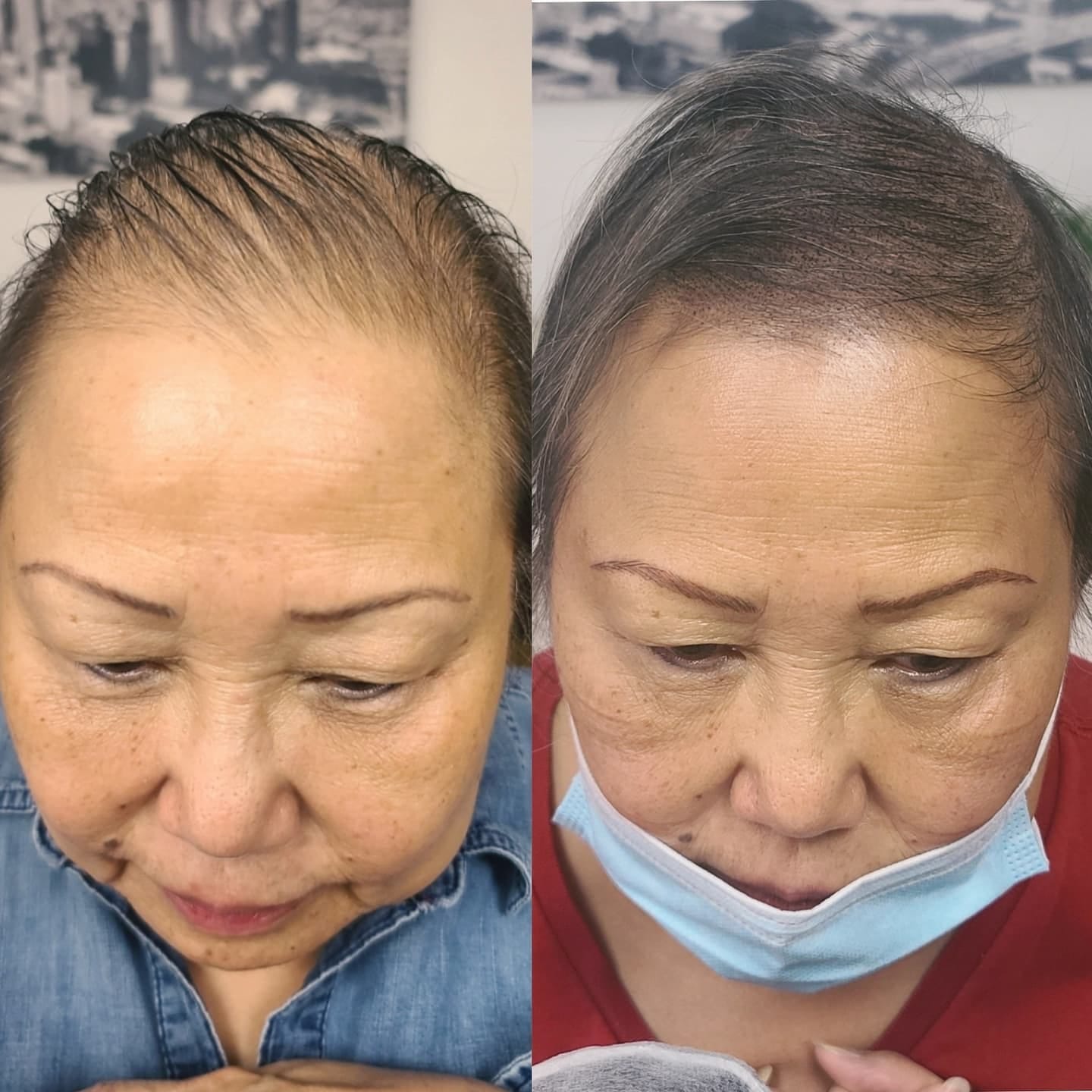 Customer photo review of Nolya Red Light Therapy Hair Brush