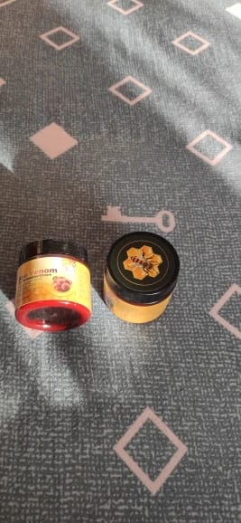 Customer photo review of BeeVita Joint Comfort Cream for Knees, Elbows & Shoulders