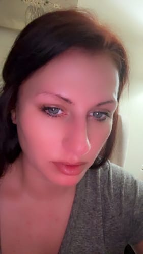 Customer photo review of Collagen Niacinamide Jelly Cream