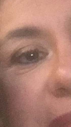Customer photo review of Quia Collagen Eye Patches