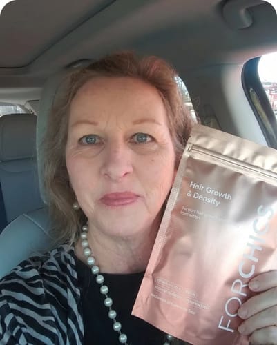 Customer photo review of ForChics Hair Growth Density