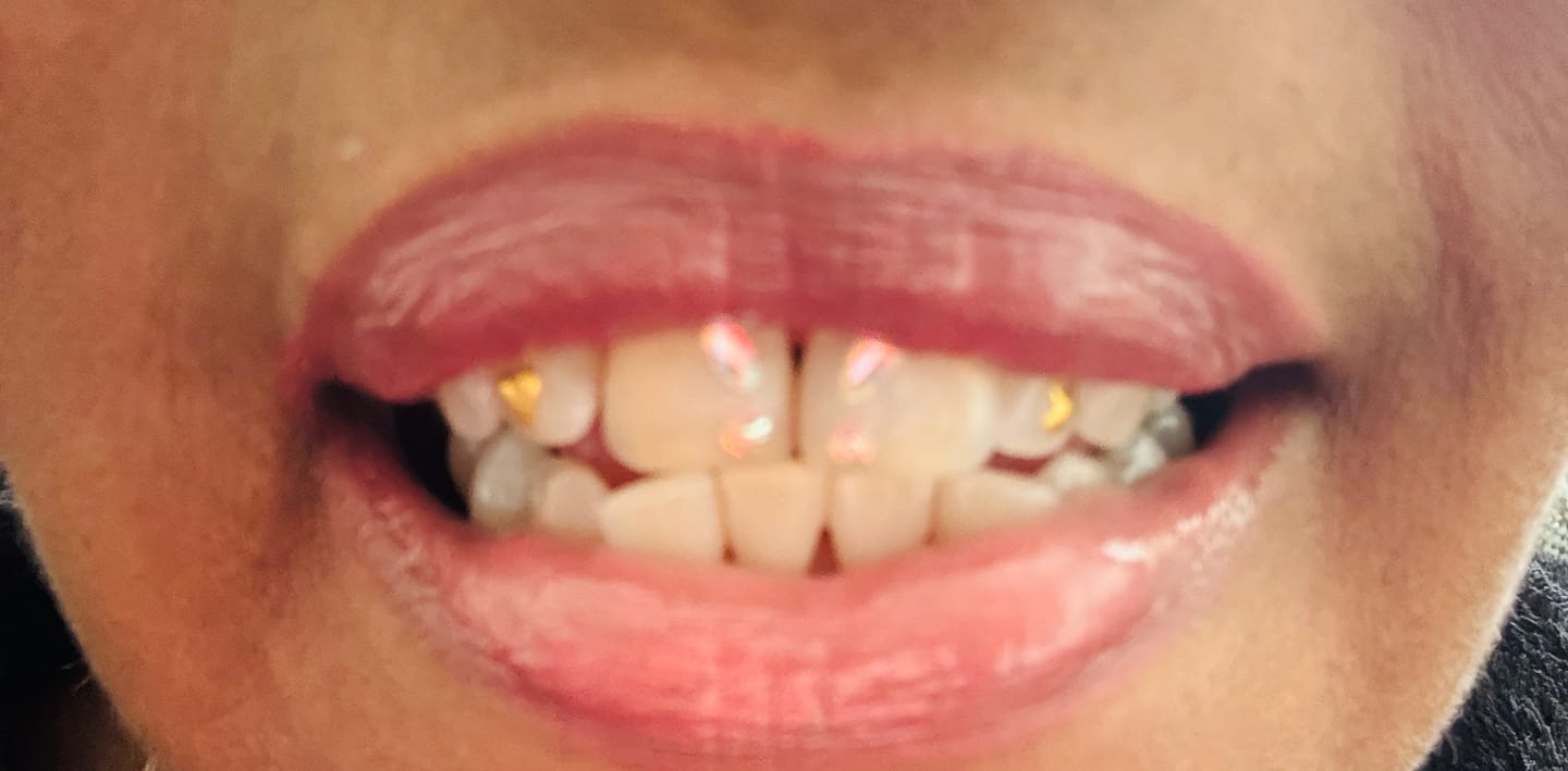 Customer photo review of Crystal Aurore Boreale Butterfly Tooth Gem – Swarovski®