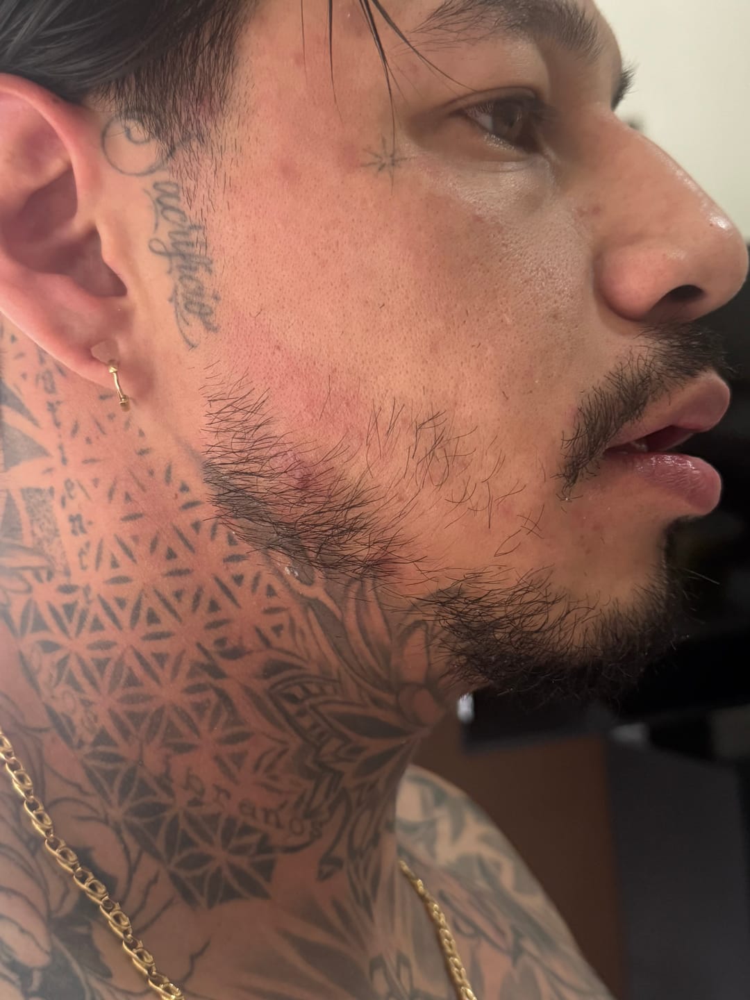 Customer photo review of Bálsamo Mélamus - Minoxidil 20%