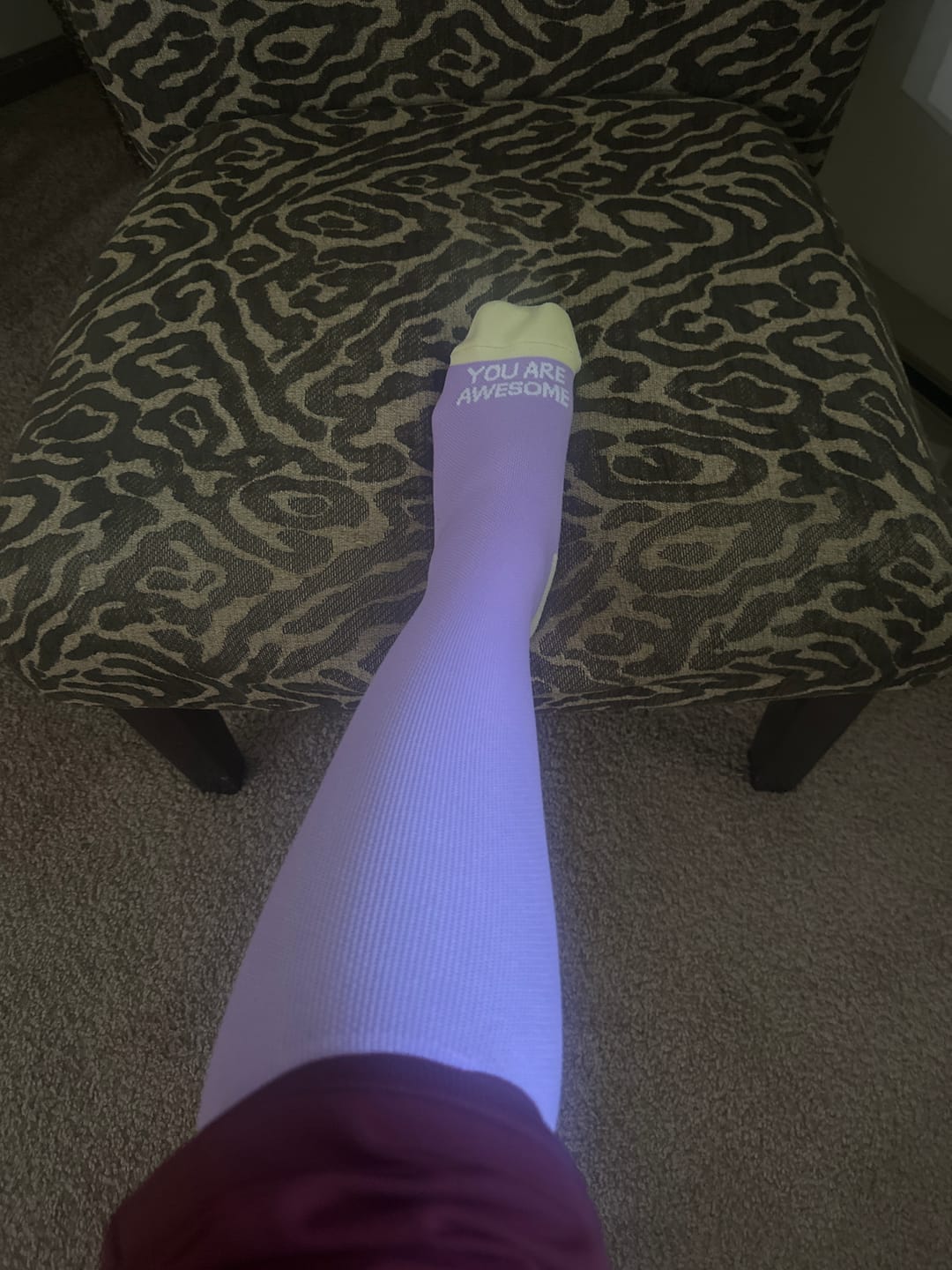 Customer photo review of NurseStrong Performance Compression Socks