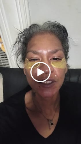 Customer photo review of Quia Collagen Eye Patches