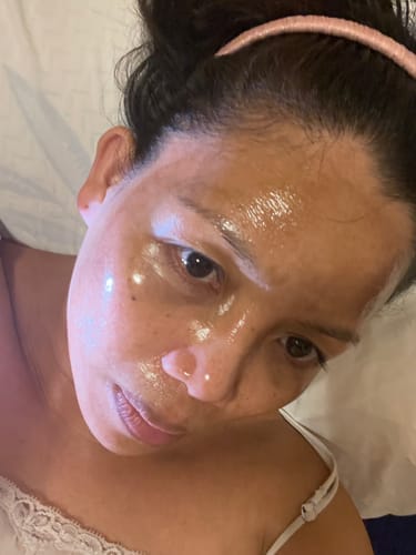 Customer photo review of Collagen Jelly Cream with Niacinamide