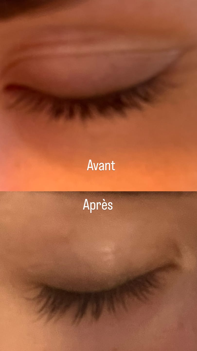 Customer photo review of SÉRUM DE CROISSANCE POUR CILS