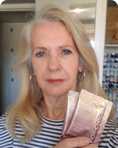 Customer photo review of ForChics Hair Growth Density