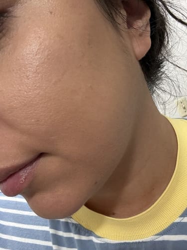 Customer photo review of Supreme Skin Set