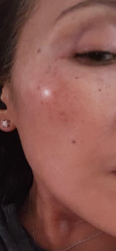 Customer photo review of Collagen Niacinamide Jelly Cream